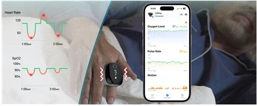 O2Ring Wireless Bluetooth Pulse Oximeter with Vibration Alarms